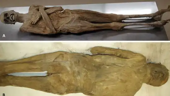 Eski Mısır'ın Sırlarını Saran Mummy: Kurutulmuş Papazın Gizemi Çözüldü!